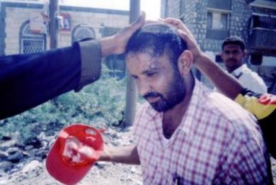احد عمال الاتصالات بلودر يتعرض للاصابة في رأسه بحجارة المتظاهرين