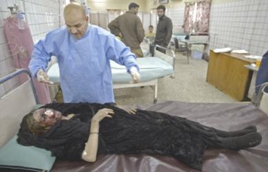 تشوه وجة امرأة عراقية جرحت في العملية الانتحارية 