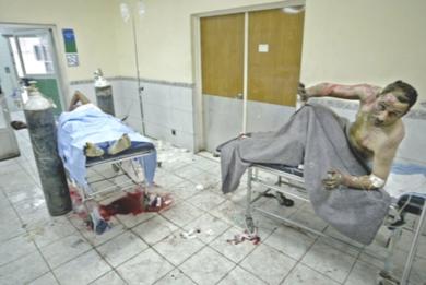 مصابون يتلقون العلاج في احدى المستشفيات العراقية