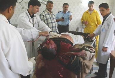 أطباء عراقيين يحاولون انقاذ احد الجرحى يوم امس
