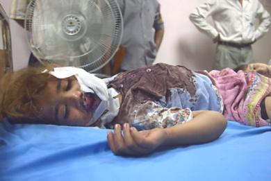 طفلة عراقية مصابة تتلقى الاسعافات الاولية في احدى المستشفيات الحكومية
