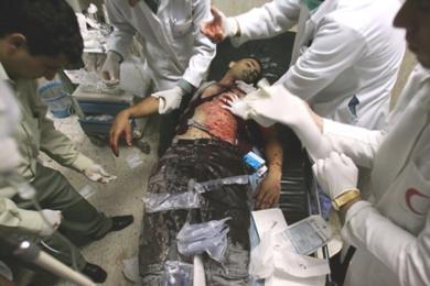 أطباء فلسطينيون يحاولون انقاذ احد الجرحى .. دون جدوى