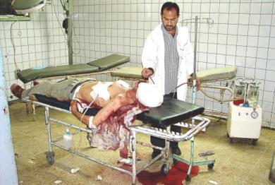 طبيب عراقي يقوم بمعاينة احد الجرحى