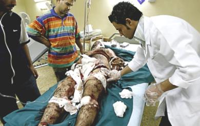 طبيب عراقي يعالج احد الجرحى  