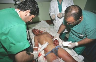 أطباء فلسطينيون يعالجون احد الجرحى 