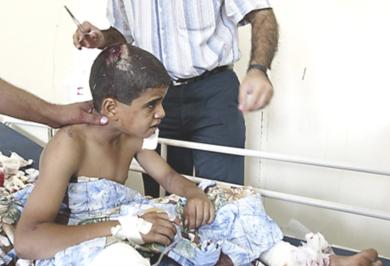 طفل عراقي مصاب يتلقى العلاج بعد اصابته في انفجار أمس
