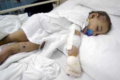 الطفلة علا علي (سنتان) التي أصيبت مع أسرتها في غارات الخميس على مرجعيون ترقد في مستشفى ببيروت أمس