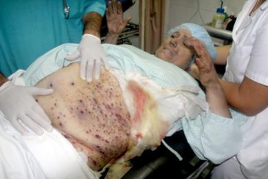 المواطنة اللبنانية زكية موانس التي اصيبت في القصف على مدينة صور في المستشفى بصيدا امس 