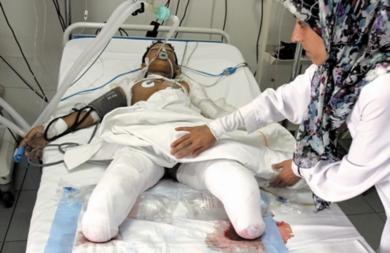 الصبي اللبناني محمد سمير موسى (14 عاما) يرقد أمس في المستشفى بمدينة صور مبتور الساقين بعد إصابته في غارة إسرائيلية