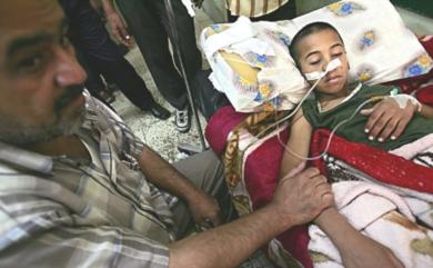 طفل عراقي اصيب في الانفجار وسط الزعفرانية