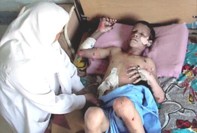 ممرضة عراقية تعالج فتى اصيب في الانفجار