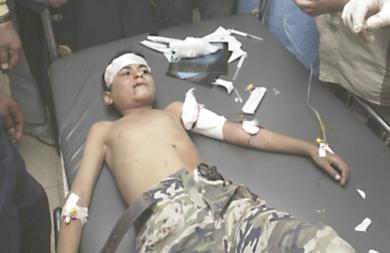 فتى عراقي يعالج بعد اصابته في احدى الهجمات
