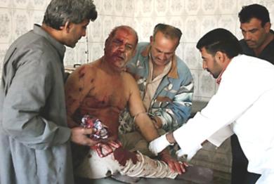 طبيب عراقي يعالج احد المصابين