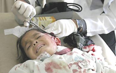 طبيب عراقي يعالج فتاة اصيبت في احدى الهجمات