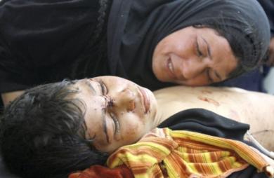 امرأة عراقية تبكي بجانب ابنها المصاب في احدى المستشفيات