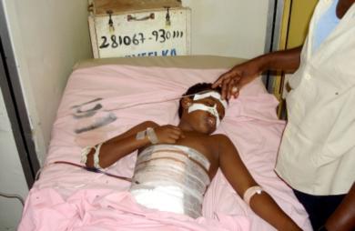 فتى صومالي مصاب في المستشفى