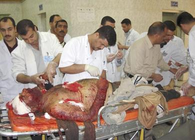 طبيب عراقي يحاول انقاذ احد المصابين في حالة خطرة