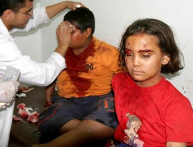 طبيب عراقي يعالج اطفال اصيبو في الانفجار