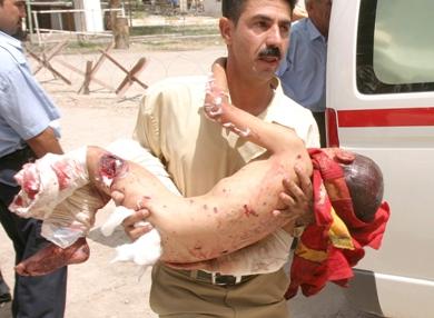 عراقي يحمل جثة طفل قتل في احدى الهجمات