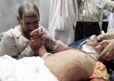 اب عراقي يبكي أثناء مسكه يد ابنته المصابه