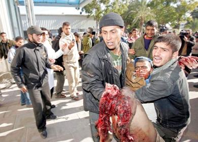 فلسطينيون ينقلون احد المصابين بعد أن بترت اطرافه السفلى
