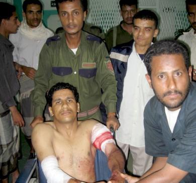 المصابين من جنود الأمن المركزي في المستشفى أمس