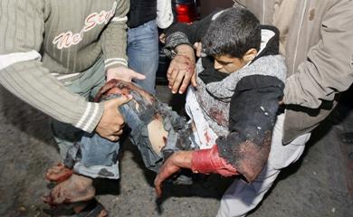 صبي إصابته بالغة ينقل إلى أحد مستشفيات غزة أمس