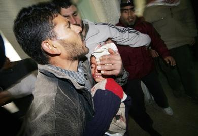 صورة لطفل يسعف إلى مستشفى غزة