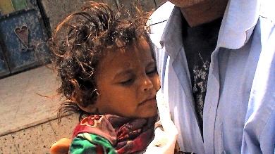 طفلة تسعف بعد اصابتها باختناق قنابل مسيلة للدموع