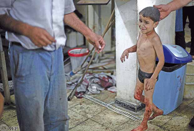 طفل سوري مصاب يبكي وهو يبحث حوله عن أبيه في المستشفى في دوما يوم أمس بعد أن أصيب في غارة جوية للقوات النظامية