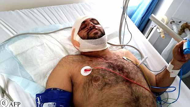 مصاب يتلقى العلاج في أحد المشافي بصنعاء أمس