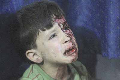 طفل سوري يبكي مصاب بعد الغارة الجوية 