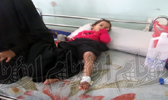 طفلة مصابة جراء قصف قوات الجيش لمناطق الضالع