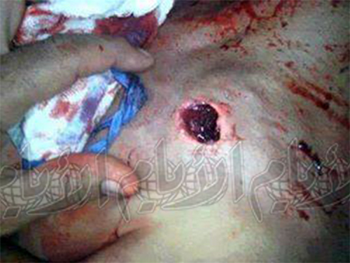  الرصاصة الذي اخترقت جسم الشاب عدلي محمد عبد الله
