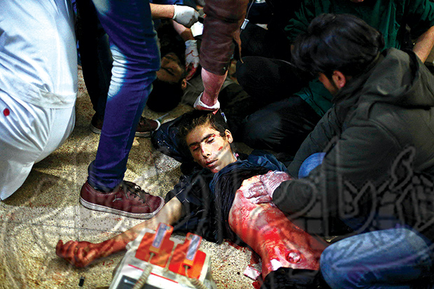 أطباء يحاولون إنعاش صبي سوري في دوما أمس