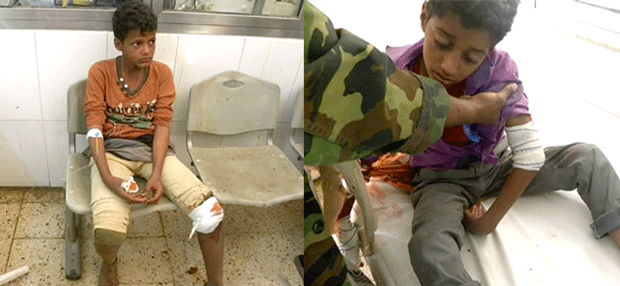 أصابة طفلان برصاص قناص حوثي