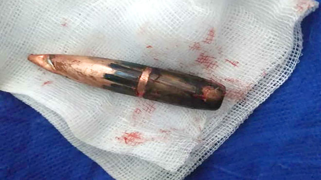 رصاصة حوثية تصيب امرأة في حيفان