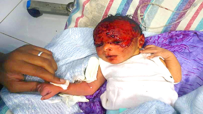 صورة للطفل وعلى جبينه الدماء