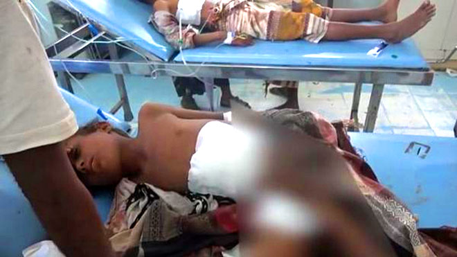 إصابة طفلين بانفجار مقذوف في الخوخة
