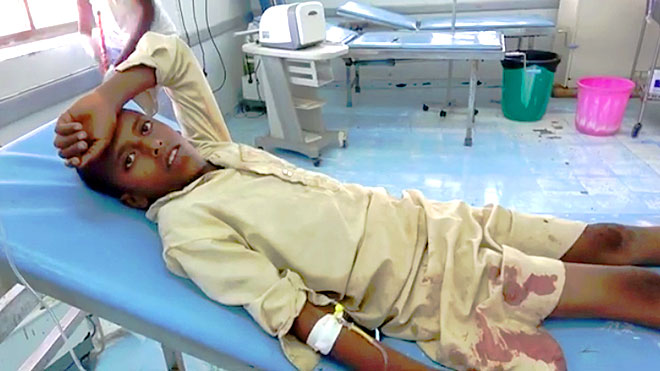 أصابة طفل برصاص الحوثي في حيس