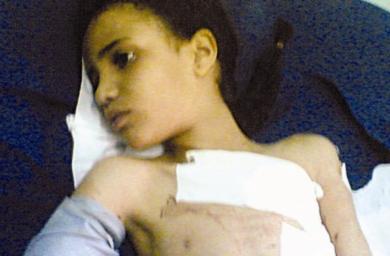 الطفلة المصابة عائشة محمد العماقي في المستشفى الطفلة المصابة عائشة محمد العماقي في المستشفى