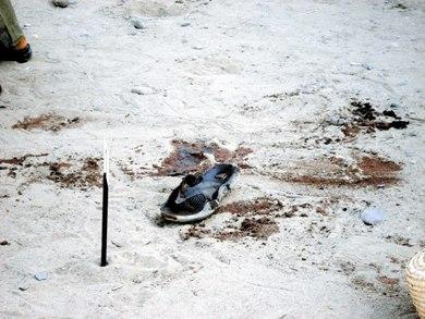 آثار دماء المجني عليه أيمن وتبده حذاؤه ملطخة بدمه آثار دماء المجني عليه أيمن وتبده حذاؤه ملطخة بدمه