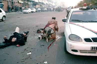 رجلان أصيبا بعد تفجير احد الانتحاريين رجلان أصيبا بعد تفجير احد الانتحاريين