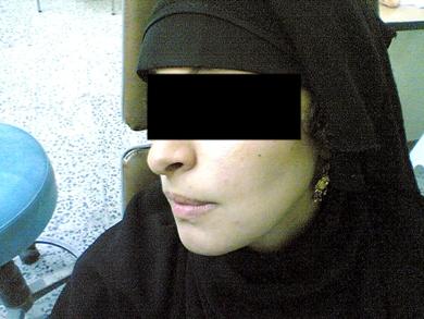 بعد العملية بعد العملية
