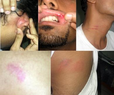 صور للمعتدى عليهم بعد عشر ساعات ونصف الساعة من الحادث صور للمعتدى عليهم بعد عشر ساعات ونصف الساعة من الحادث