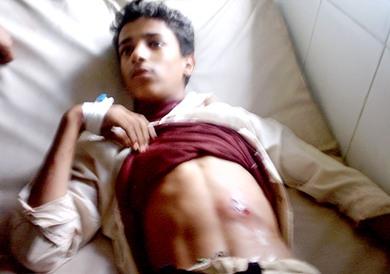 الجريح موسى صالح رضوان في الضالع الجريح موسى صالح رضوان في الضالع