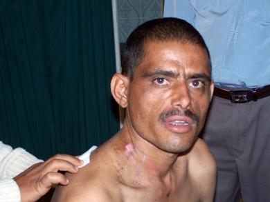 صورة توضح الجندي ومكان خروج الطلقة صورة توضح الجندي ومكان خروج الطلقة