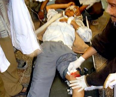 مصاب من الشعيب مصاب من الشعيب