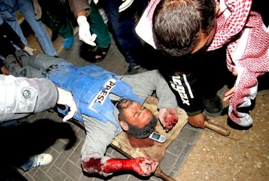 صحفي فلسطيني يسعف إلى مستشفى الشفاء بغزة بعد قصف إسرائيلي لمكتب يضم عددا من وسائل الإعلام أمس صحفي فلسطيني يسعف إلى مستشفى الشفاء بغزة بعد قصف إسرائيلي لمكتب يضم عددا من وسائل الإعلام أمس