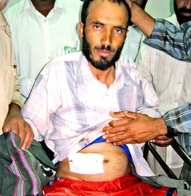 محمد علي بن علي شظية في بطنه محمد علي بن علي شظية في بطنه